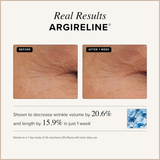 Anti-Aging Face Serum with Argireline, Matrixyl 3000, Vitamin C & Hyaluronic Acid – Wrinkle Treatment for Face & Neck