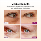 Anti-Aging Eye Balm Stick with Calcium, Collagen & Vitamin D for Wrinkle Care & Volume Support