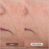 Tinted Anti-Aging Moisturizer SPF 45 for Brightening & Oil Control