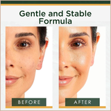 Vitamin C Face Serum with Hyaluronic Acid & Collagen – Brightening Anti-Aging Treatment for Dark Spots, Wrinkles & Uneven Skin Tone